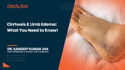 Cirrhosis &amp; Limb Edema: What You Need to Know!