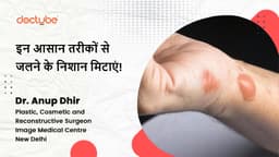 इन आसान तरीकों से जलने के निशान मिटाएं!