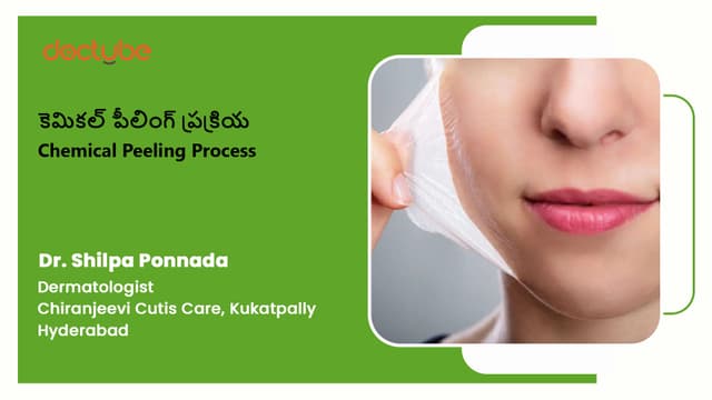 కెమికల్ పీలింగ్ ప్రక్రియ | Chemical Peeling Process