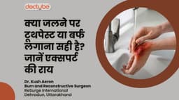 क्या जलने पर टूथपेस्ट या बर्फ लगाना सही है? जानें एक्सपर्ट की राय