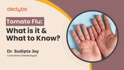 Tomato flu: What is it and what to know? Tomato flu: What is it and what to know?