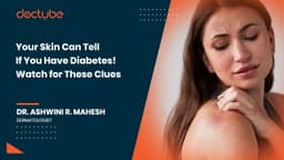 Your Skin Can Tell If You Have Diabetes! Watch for These Clues Your Skin Can Tell If You Have Diabetes! Watch for These Clues