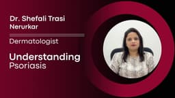 Understanding Psoriasis Understanding Psoriasis