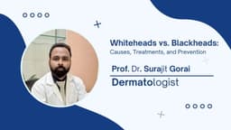 Whiteheads vs. Blackheads: Causes, Treatments, and Prevention Whiteheads vs. Blackheads: Causes, Treatments, and Prevention